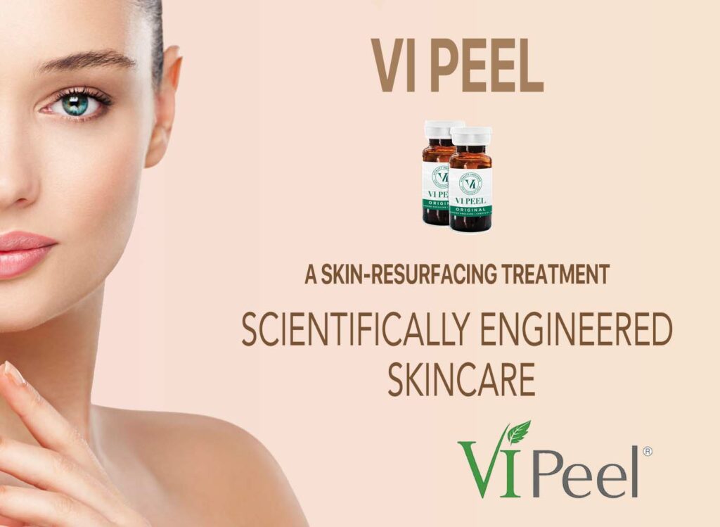 VI Peel Ad