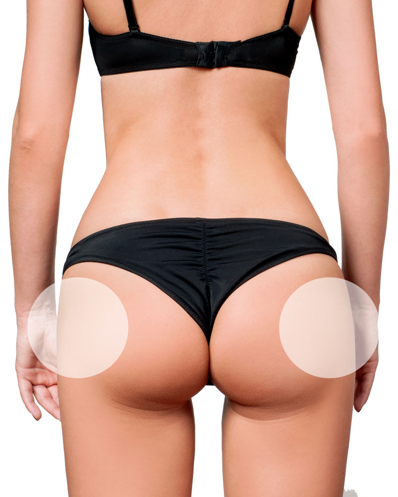 Laser Hair Removal Hips