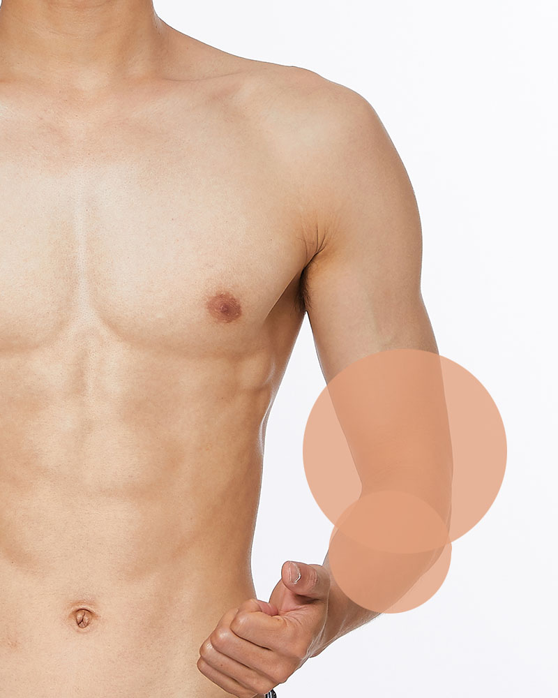 Laser Hair Removal Male Arms